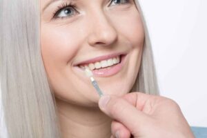 Pros and Cons of Dental Veneers