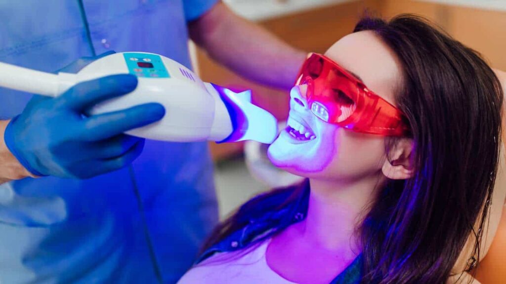 laser teeth whitening