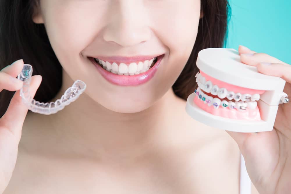 How Does Invisalign Work?